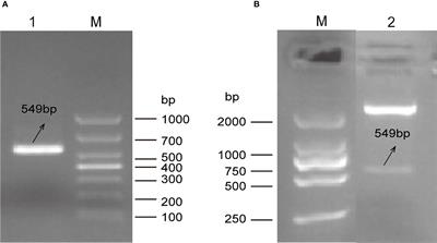 Molecular characterization and protective efficacy of vacuolar protein sorting 29 from Eimeria tenella